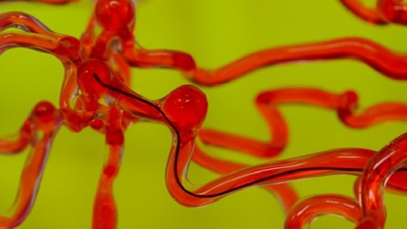 麻省理工開發(fā)磁控線性機(jī)器人，能在腦血管中自由穿梭